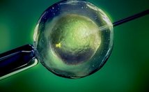 在浙江省做试管婴儿长方案周期需要多久？超长方案促排流程是怎么样的？