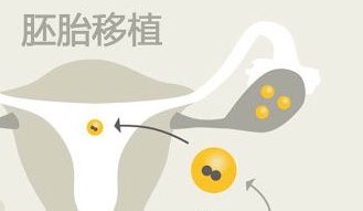 2026年艾滋病患者在吉林省人民医院做试管的费用多少？贵吗？